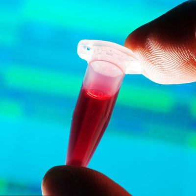 آزمایشگاه های آزمایش تایید شده FDA مواد غذایی با تشخیص سریع تماس با شیشه شیر کودک سرویس احراز هویت شخص ثالث